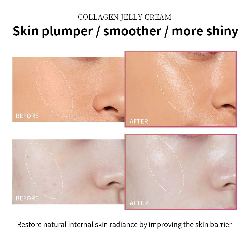 Lakerain Collagen Jelly Cream Hydrating Face Moisturizer – Lightweight Glow Skin Hydration Cream 100ml