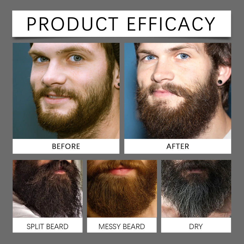 Beard Growth Serum Set with Roller – CPNP Certified