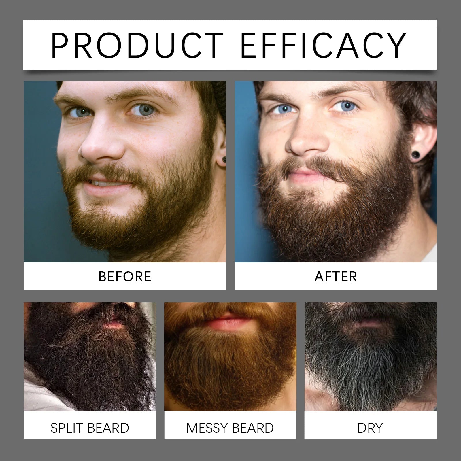 Beard Growth Serum Set with Roller – CPNP Certified