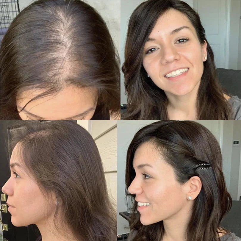 Breathable Silk Base Hair Topper