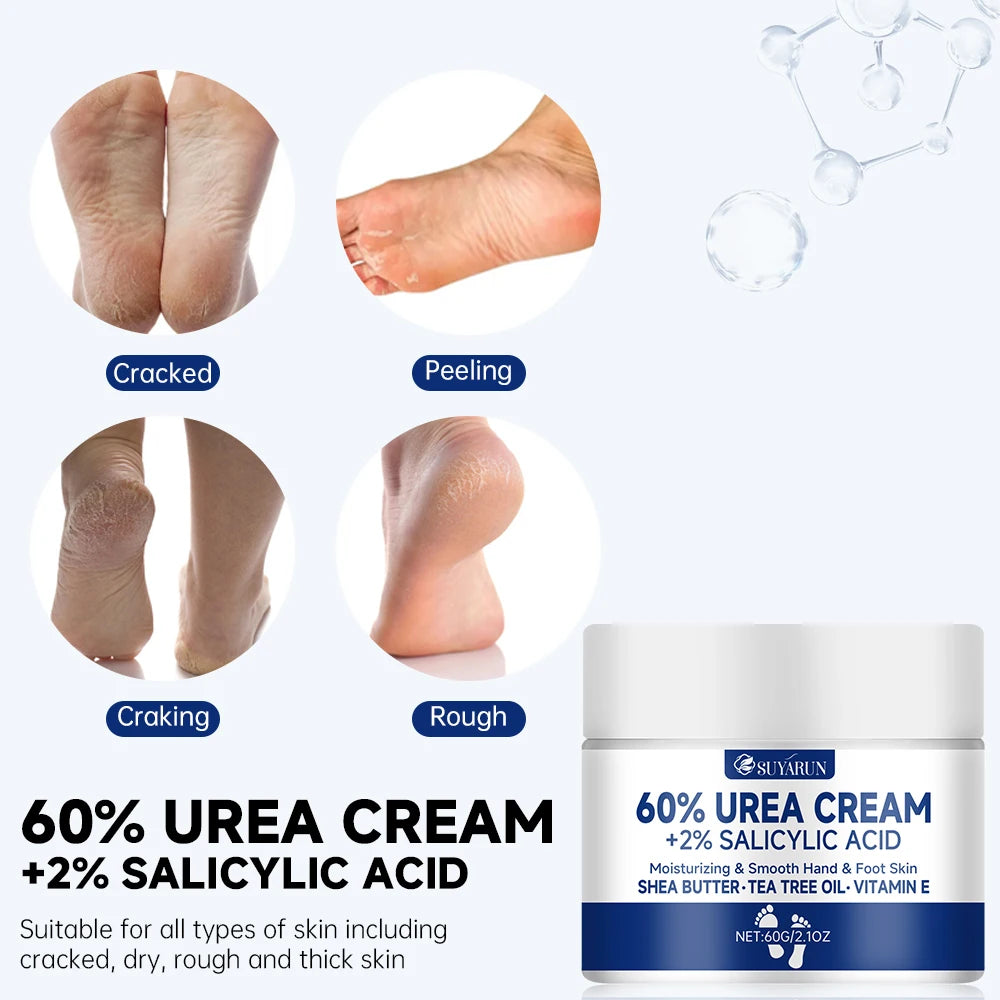 60% Urea Foot Cream for Cracked Heels & Dry Skin | Callus Remover & Intensive Foot Care