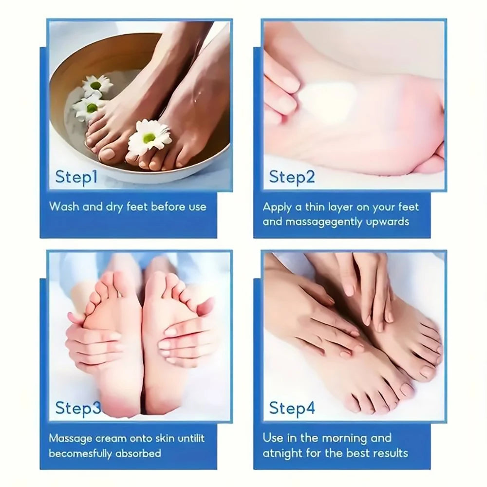 60% Urea Foot Cream for Cracked Heels & Dry Skin | Callus Remover & Intensive Foot Care