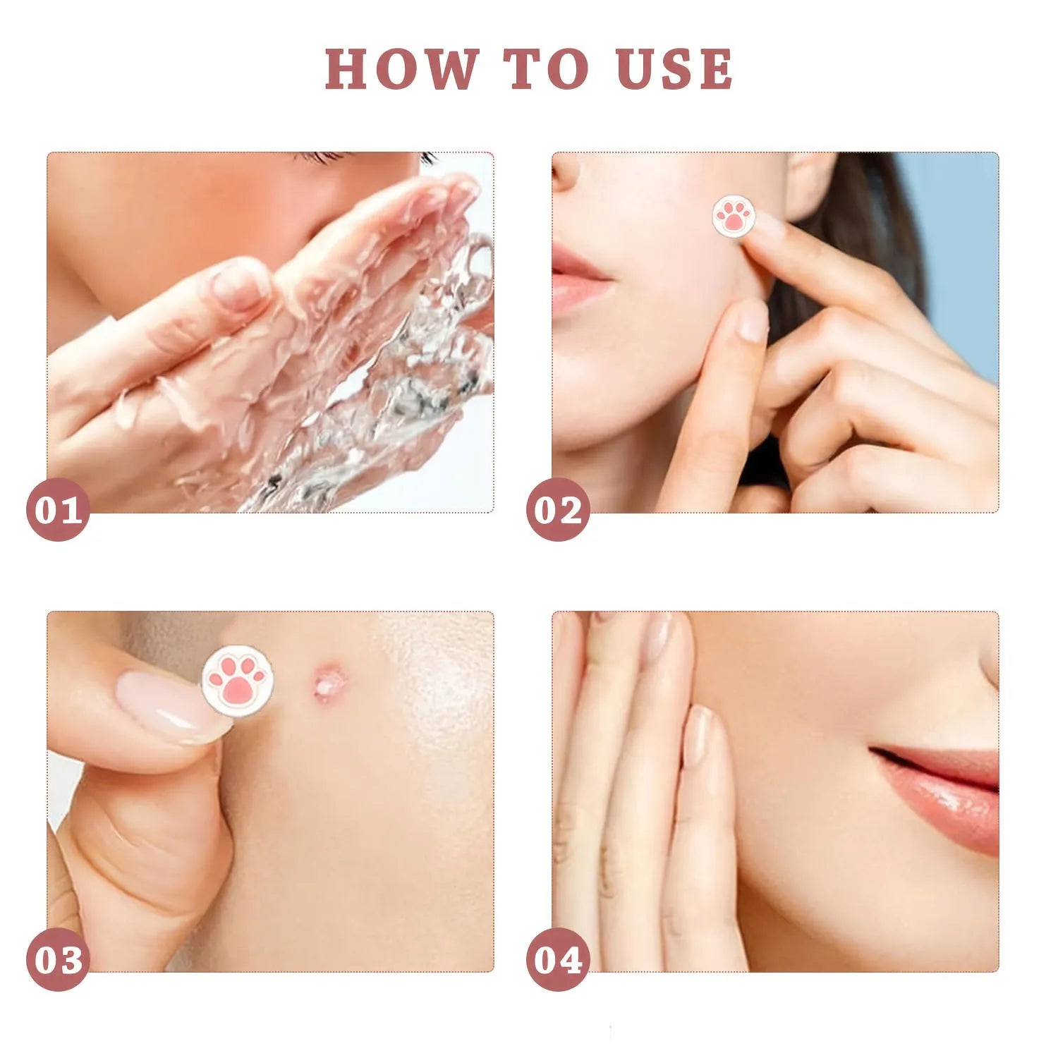 HITWORKER Cute Hydrocolloid Acne Patches (216pcs)
